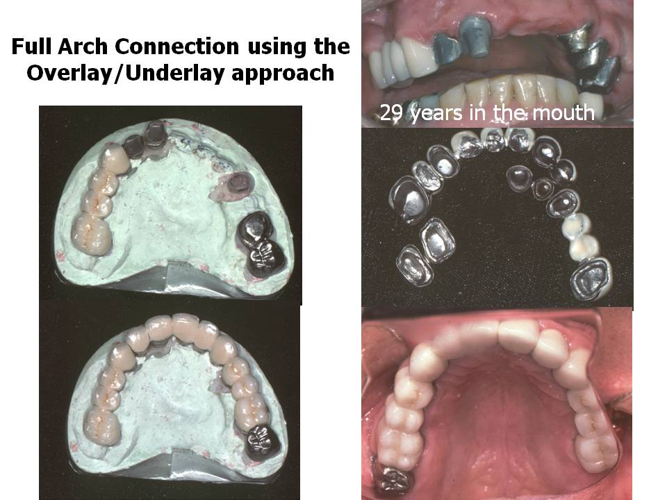 what-is-major-restorative-dental-work-hertzberg-scarboro99